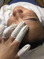 -苗颜坊专业祛痘全国连锁机构