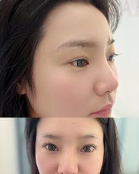 -德绣·机器野生眉发际线·美瞳线半永久