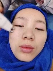 -南昌臻爱医疗美容