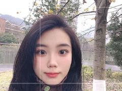-黑马眼科·近视手术
