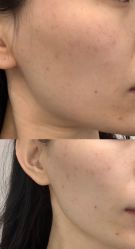 点击看大图 -亿美医疗美容·半岛大超炮官方授权店