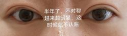 体验后-海峡医疗美容医院