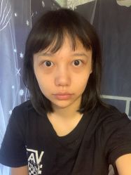 体验前-广州美莱医疗美容医院
