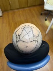 -大麦微针植发全国连锁