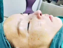 -弘美医美·艾维岚童颜抗衰中心