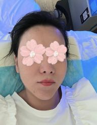 点击看大图 体验后-宸山医美·变美艺术馆