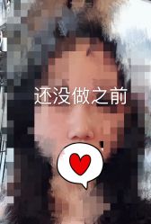-深圳鹏爱悦心医疗美容医院