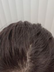 -熙朵美学植发连锁