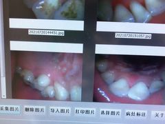 -团圆口腔·种植中心(锦江院区)