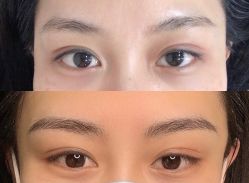 点击看大图 -久匠·纹眉半永久野生眉