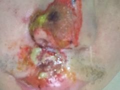 -上海市第五人民医院