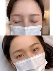 -Doris多里斯半永久纹眉·SMP纹发·发际线