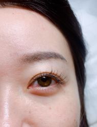 -宥莉·ULLY 痘敏肌•科技皮肤管理中心