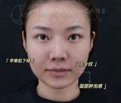-MLP美丽派·问题肌疗愈中心