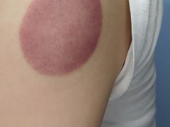 -元大中医连锁·疼痛推拿理疗·艾灸(紫竹园店)