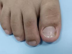 -世龙世家手足健康护理连锁(福田梅林路润裕花园店)