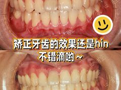 -Dr.Z dental仁康种植矫正中心