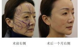 -丰联丽格医疗美容·联合丽格眼整形中心