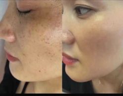 -美愈美肤MEIYU SKIN