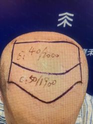 -雍禾植发全国连锁