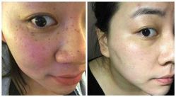-SKINIST丽铂医疗美容