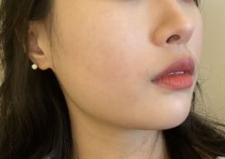 -素美医疗美容·西南眼鼻整形·修复基地