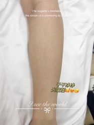 -植蔻妍倍儿专业脱毛·皮肤管理