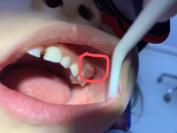 -青苗儿童口腔(长楹天街购物中心)