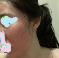 -新美荟医美·专注面部美学抗衰