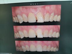 -牙博士口腔品牌连锁(杨浦店)