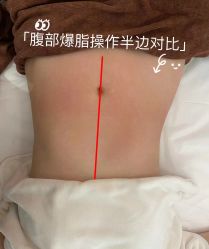 -Lily纤美·科技减脂中心