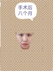 -八大处整形