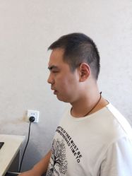 点击看大图 -大麦微针植发丨全国连锁