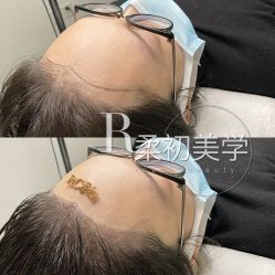 -RC半永久纹眉纹发际线