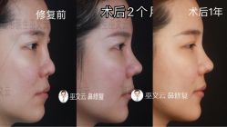 -北京米扬丽格医疗美容·联合丽格鼻整形中心