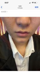 -铂特丽医美·眼鼻整形·光电美肤·注射抗衰