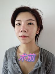 -天津时光诺颜·轻医美·轮廓抗衰中心