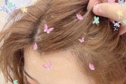 -大麦微针植发全国连锁