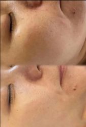 -SKIN79皮肤管理中心