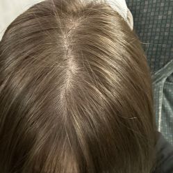 -MI HAIR