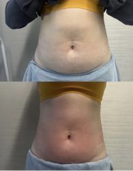 -Lily纤美·科技减脂中心