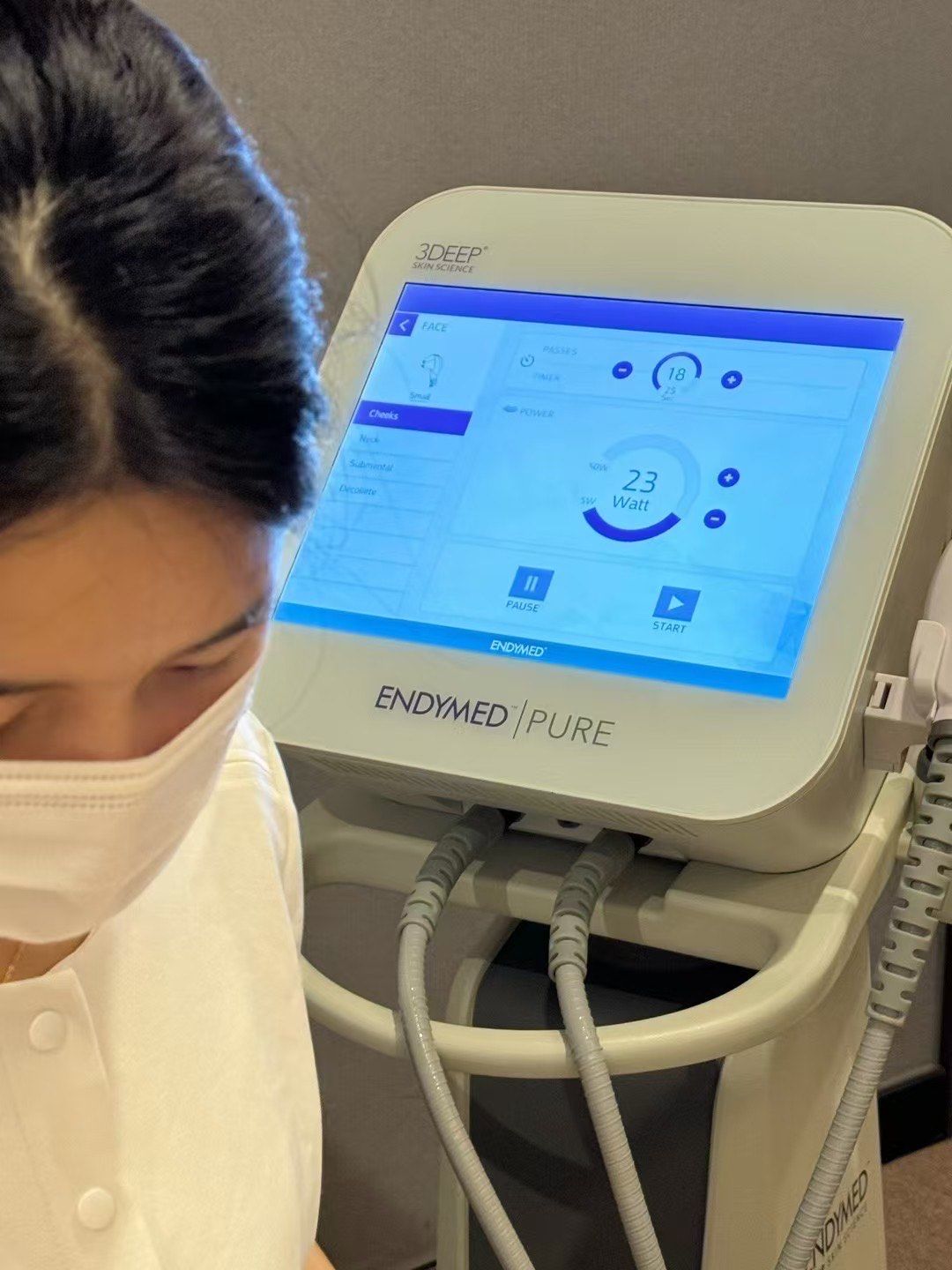 又无痛提升效果又明显
欧美明星都在做的以色列endymed
卡戴珊和