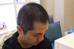 -大麦微针植发丨全国连锁