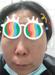 体验后-坤如玛丽·医疗美容中心