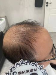 -唐风采假发补发定制