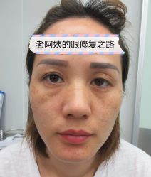 -素美医疗美容·西南眼鼻整形·修复基地