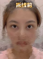 -素美医疗美容·西南眼鼻整形·修复基地