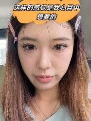 -素美医疗美容·西南眼鼻整形·修复基地