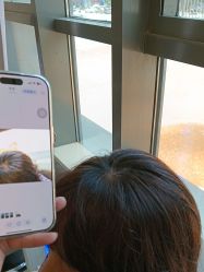 -碧莲盛·不剃发植发