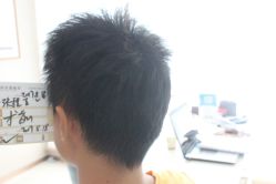 点击看大图 -大麦微针植发丨全国连锁